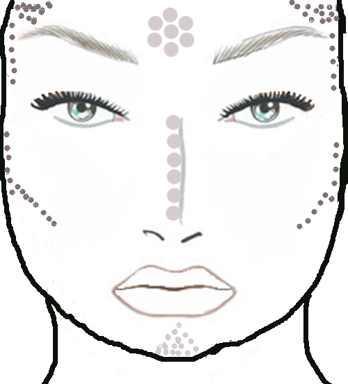 correccion-rostro-redondo