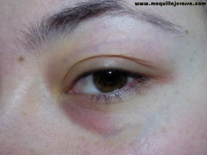 ojeras ojeras