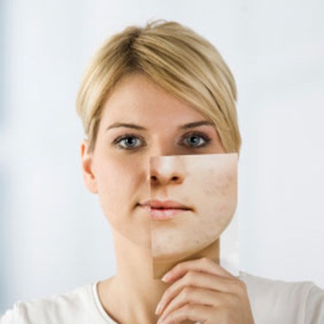 Maquillaje para disimular cicatrices